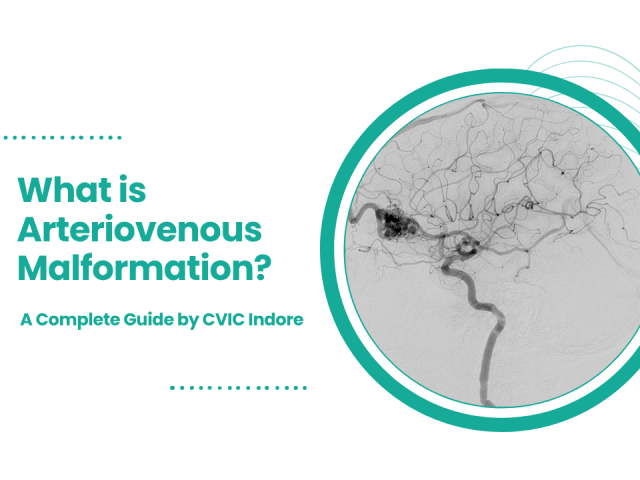 What is Arteriovenous Malformation? A Complete Guide by CVIC Indore