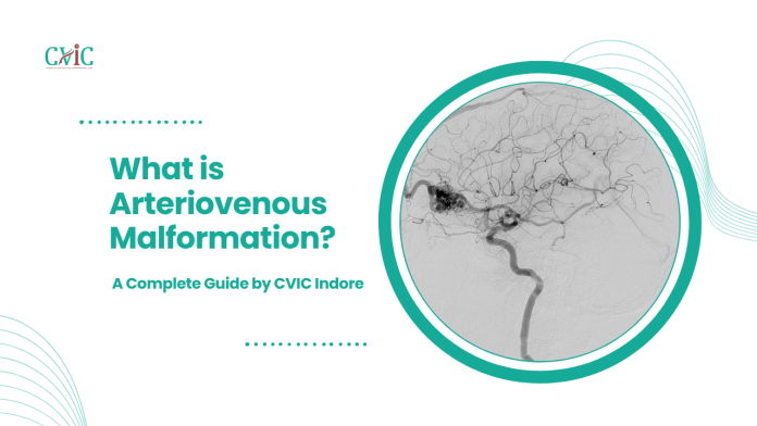 Arteriovenous Malformation