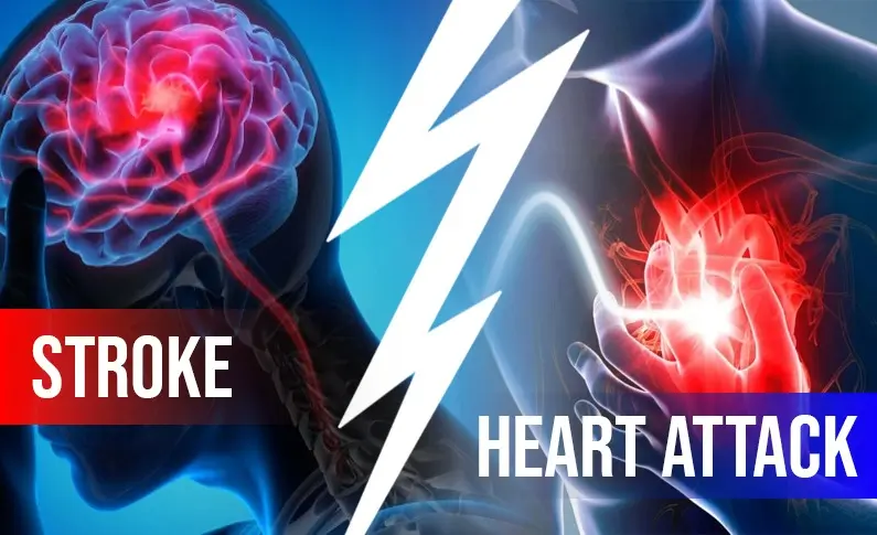 Stroke vs Heart Attack