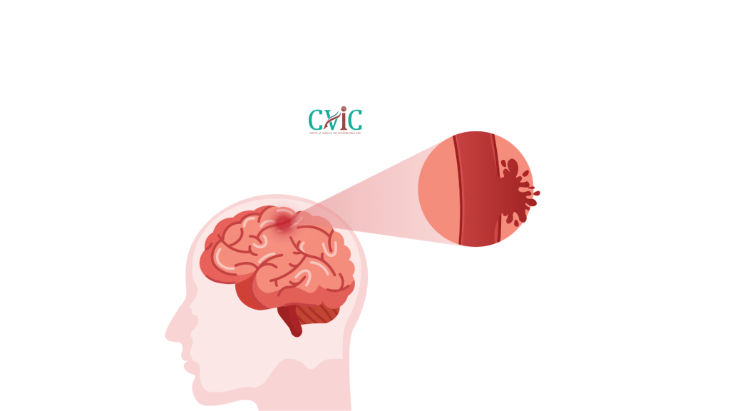 Headache vs Brain Tumor