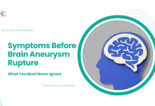 Symptoms Before Brain Aneurysm Rupture: What You Must Never Ignore Symptoms Before Brain Aneurysm Rupture:
