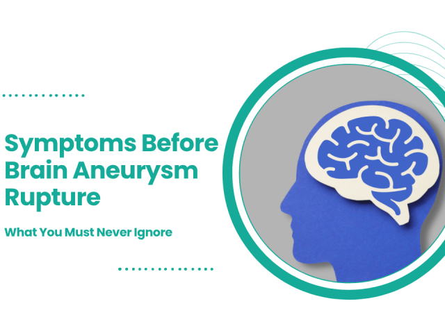 Symptoms Before Brain Aneurysm Rupture: What You Must Never Ignore