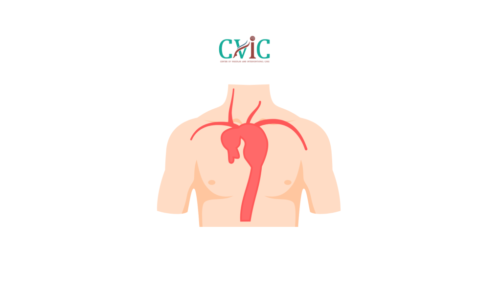 Can an Aneurysm Heal Without Surgery?