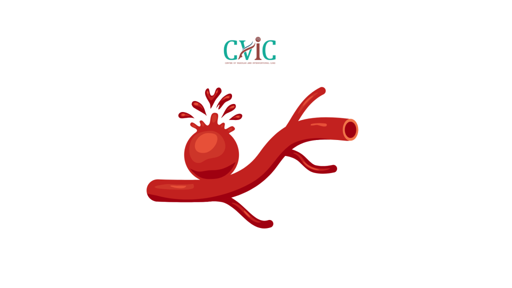 Can an Aneurysm Heal Without Surgery?