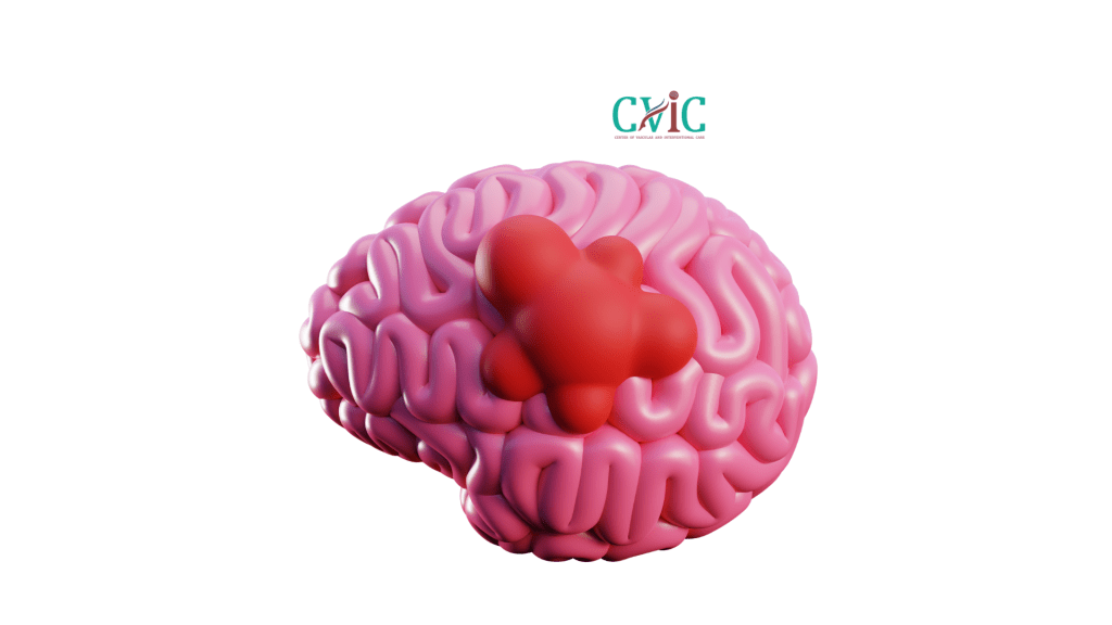 Can Brain Tumor Be Treated Without Surgery? A Complete Guide to Non-Surgical Options
