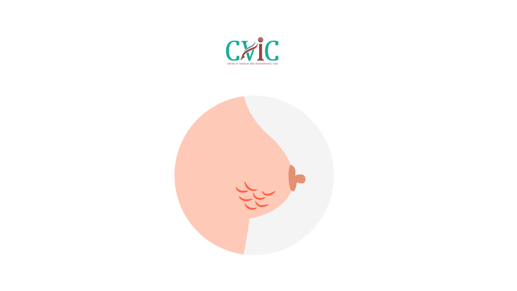 What Patients Need to Know Before a Breast Biopsy with the Encor Enspire System
