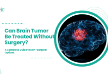 Can Brain Tumor Be Treated Without Surgery? A Complete Guide to Non-Surgical Options Can Brain Tumor Be Treated Without Surgery?