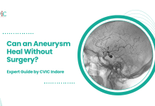 Can an Aneurysm Heal Without Surgery? | Expert Guide by CVIC Indore Can an Aneurysm Heal Without Surgery?