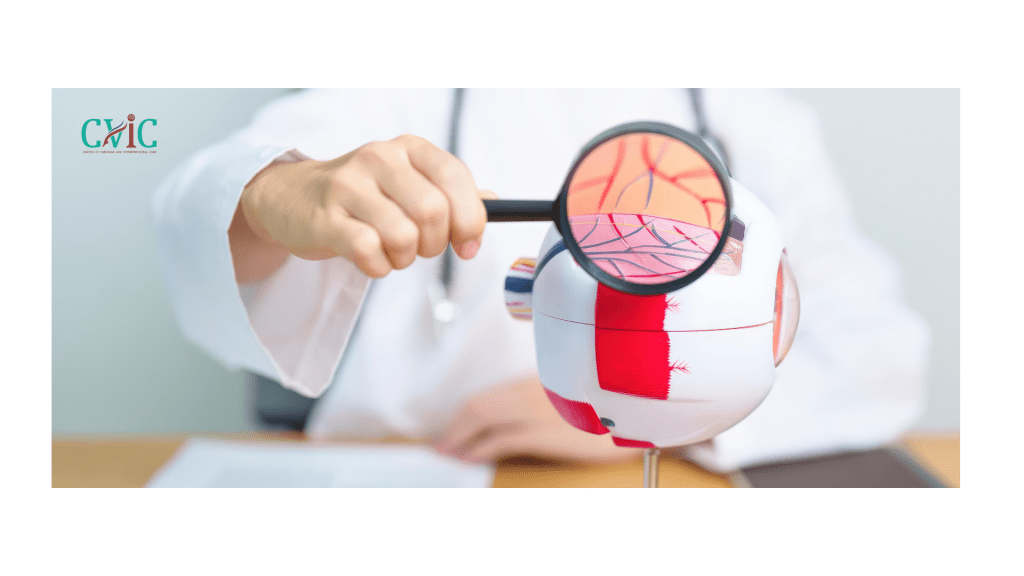 Which surgery is best for brain aneurysm – Endovascular coiling vs surgical clipping treatment at CVIC Indore by Dr. Alok K Udiya, Dr. Shailesh Gupta, and Dr. Nishant Bhargava near Gita Bhawan Indore