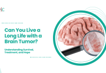 Can You Live a Long Life with a Brain Tumor? Understanding Survival, Treatment, and Hope Can You Live a Long Life with a Brain Tumor?