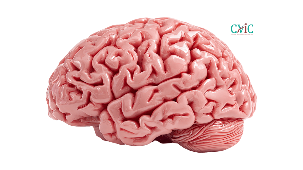 Brain tumor diagnosis and advanced treatment at CVIC Indore by Dr. Alok K Udiya, Dr. Shailesh Gupta, and Dr. Nishant Bhargava near Gita Bhawan Indore