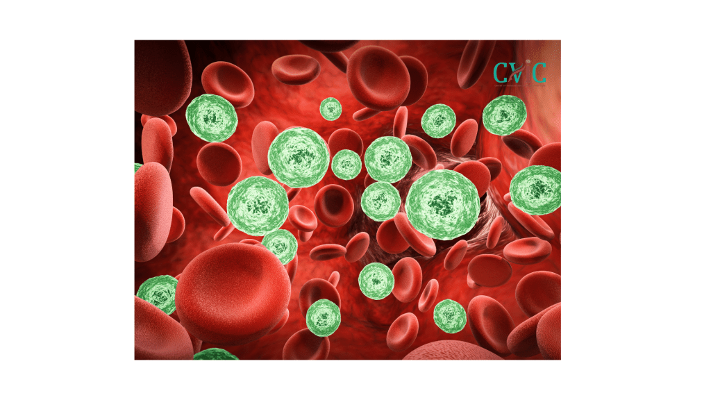 Causes of brain blood clots explained by neurovascular specialists at CVIC Indore near Gita Bhawan Indore