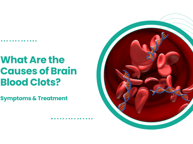 What Are the Causes of Brain Blood Clots? Symptoms & Treatment | CVIC Indore