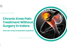 Chronic Knee Pain Treatment Without Surgery in Indore: Genicular Artery Embolization Explained Chronic Knee Pain Treatment Without Surgery in Indore