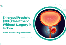 Enlarged Prostate (BPH) Treatment Without Surgery in Indore: What Is Prostate Artery Embolization? Enlarged Prostate (BPH) Treatment Without Surgery in Indore