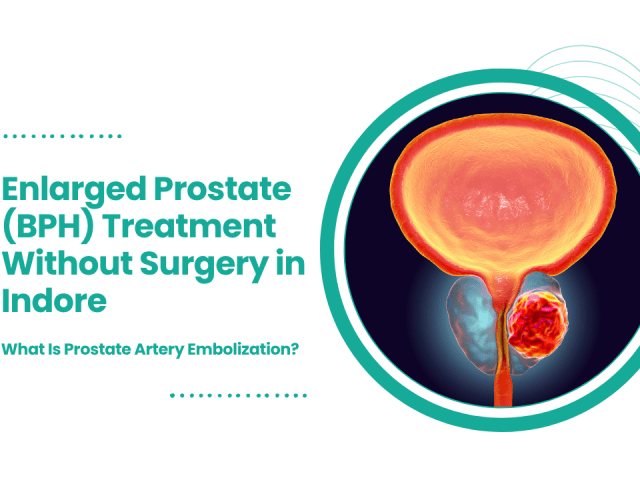 Enlarged Prostate (BPH) Treatment Without Surgery in Indore: What Is Prostate Artery Embolization?