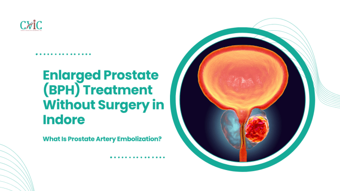 Enlarged Prostate (BPH) Treatment Without Surgery in Indore