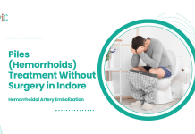 Piles (Hemorrhoids) Treatment Without Surgery in Indore: Hemorrhoidal Artery Embolization Piles (Hemorrhoids) Treatment Without Surgery in Indore