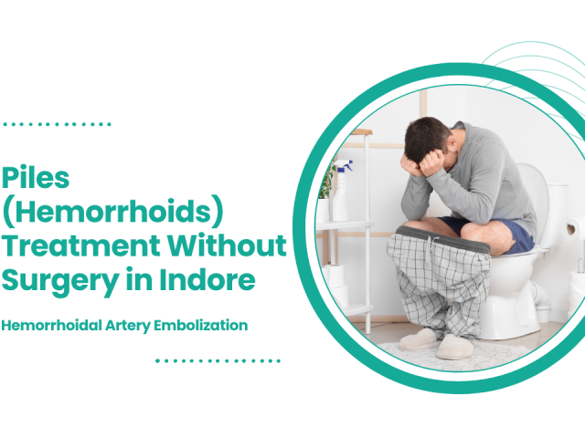 Piles (Hemorrhoids) Treatment Without Surgery in Indore: Hemorrhoidal Artery Embolization