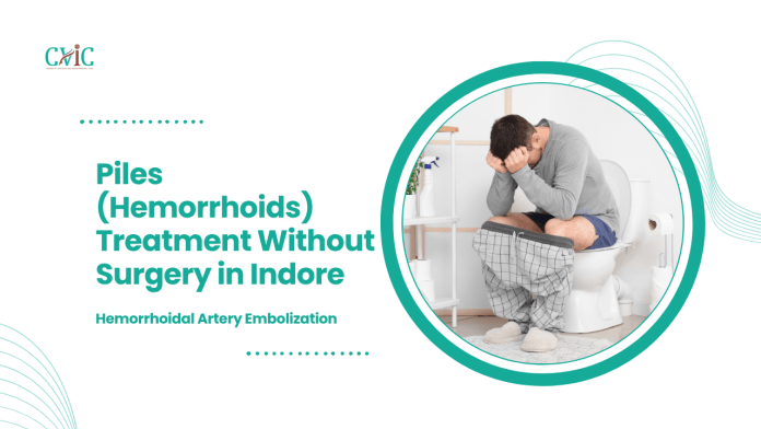 Piles (Hemorrhoids) Treatment Without Surgery in Indore