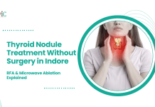 Thyroid Nodule Treatment Without Surgery in Indore: RFA & Microwave Ablation Explained Thyroid Nodule Treatment Without Surgery in Indore: RFA & Microwave Ablation Explained