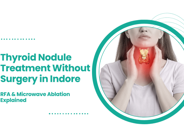 Thyroid Nodule Treatment Without Surgery in Indore: RFA & Microwave Ablation Explained