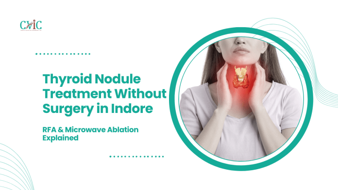Thyroid Nodule Treatment Without Surgery in Indore: RFA & Microwave Ablation Explained