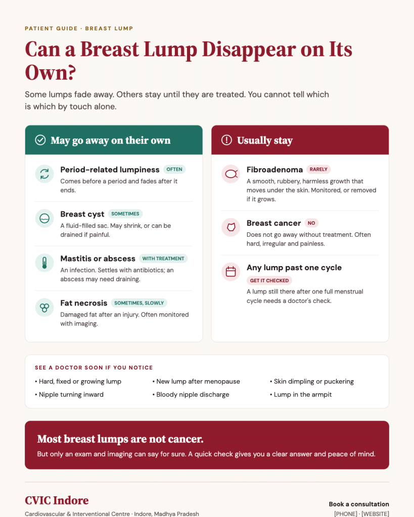 Breast lumps that may disappear on their own vs those that stay