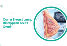 Can a Breast Lump Disappear on Its Own? Breast cross-section illustration showing a lump highlighted in blue, with an ultrasound monitor in the background.