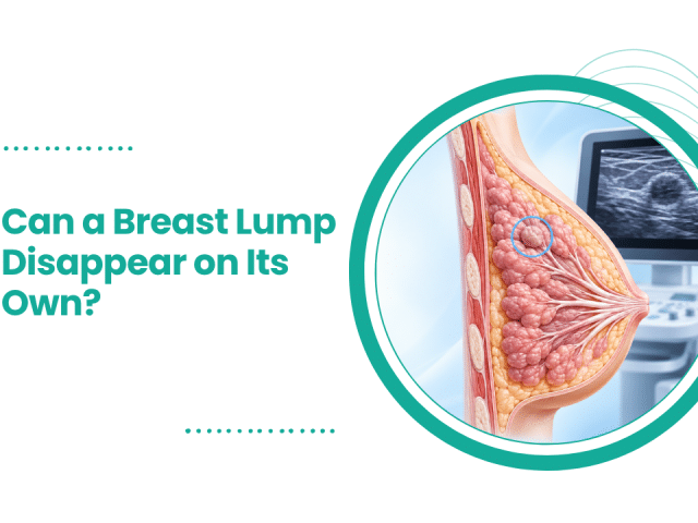 Can a Breast Lump Disappear on Its Own?
