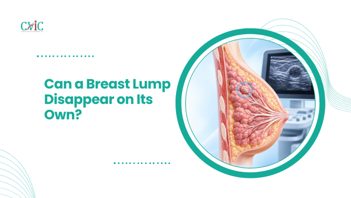 Breast cross-section illustration showing a lump highlighted in blue, with an ultrasound monitor in the background.