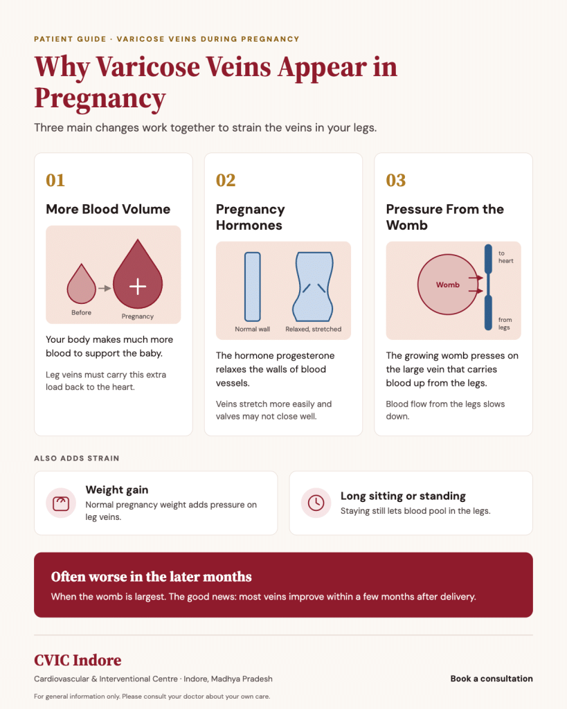 Causes of varicose veins during pregnancy