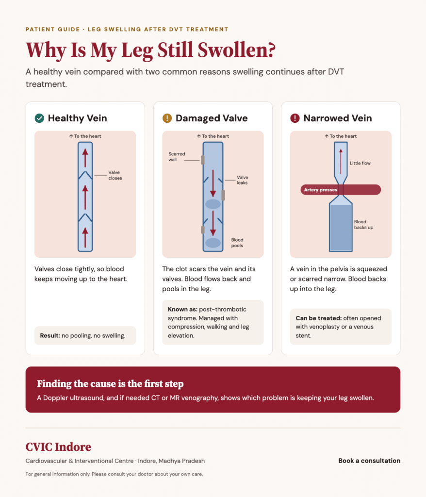 Causes of persistent leg swelling after DVT