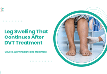 Leg Swelling That Continues After DVT Treatment: Causes, Warning Signs and Treatment Clinician examining a swollen lower leg beside the other leg, with an inset illustration of a venous valve.