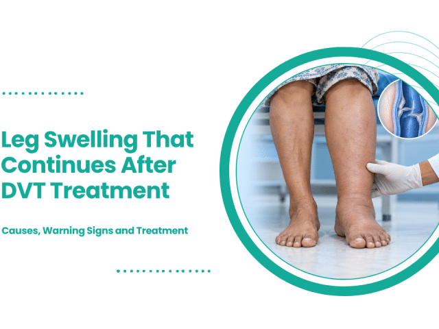 Leg Swelling That Continues After DVT Treatment: Causes, Warning Signs and Treatment