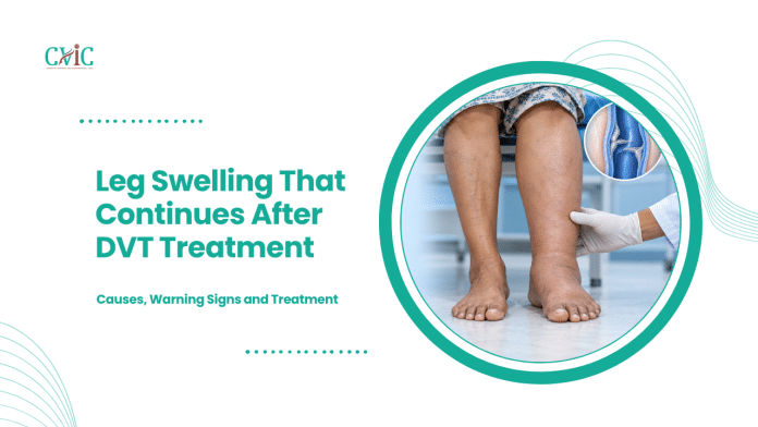Leg Swelling That Continues After DVT Treatment Clinician examining a swollen lower leg beside the other leg, with an inset illustration of a venous valve.