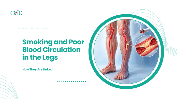 Illustration of leg arteries, a burning cigarette and a close-up of plaque narrowing an artery.