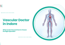 Vascular Doctor in Indore: When to See One and How to Choose the Right Specialist Human circulatory system showing red arteries and blue veins beside a definition of the word vascular.