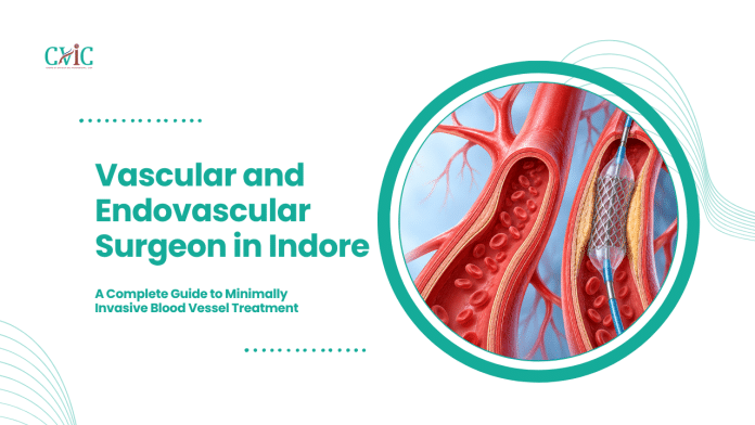 Vascular and Endovascular Surgeon in Indore Artery cutaway illustrations showing blood cells and a balloon catheter with a mesh stent inside a narrowed artery.
