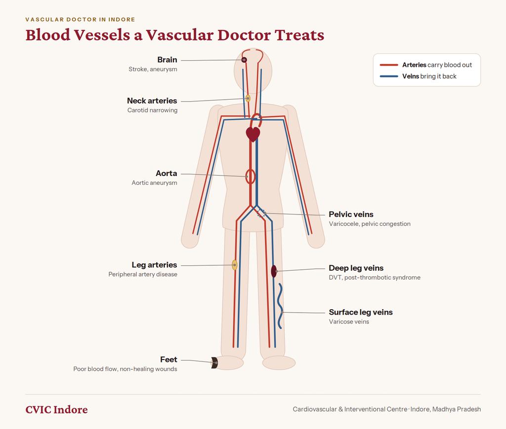 Blood vessels treated by a vascular doctor